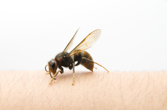 Bee Stings